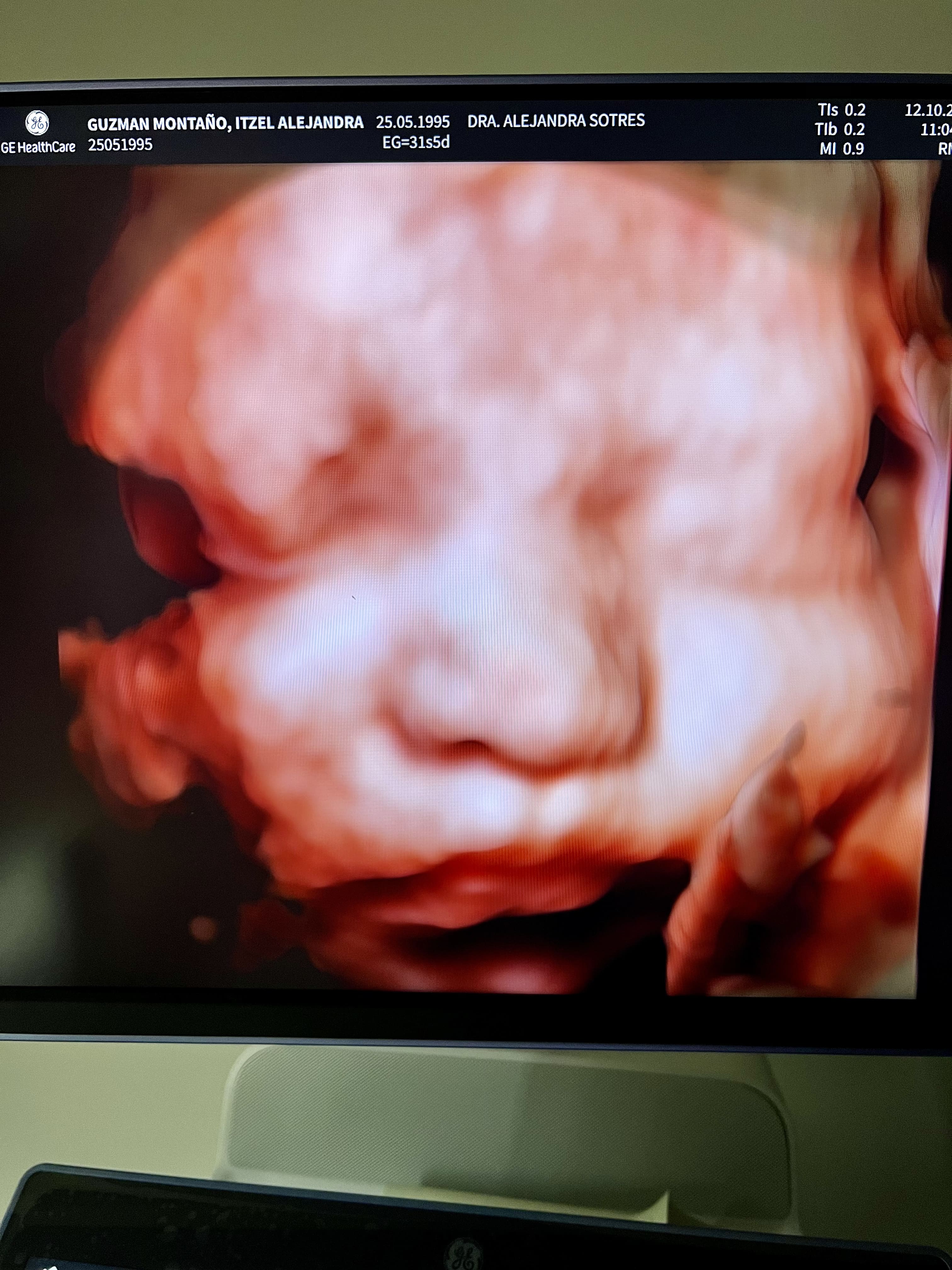 Conoce a tu Ginecóloga, Obstetra y Especialista en Medicina Materno Fetal en Naucalpan, México
